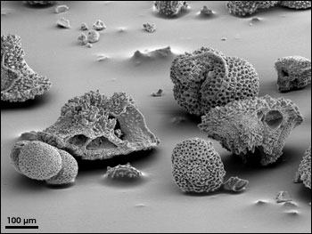 Scanning electron micrograph of foraminiferal sand taken from an ocean sediment core