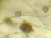 Micrograph of Dust Particles