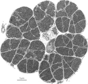 Micrograph of the Archaea Methanosarcina thermophila