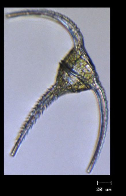 Image of a Ceratiun sp., a large dinoflagellate, sampled just south of Newfoundland as the RV Atlantis transits to the first station of the NAAMES-II mission. Photo:  Françoise Morison